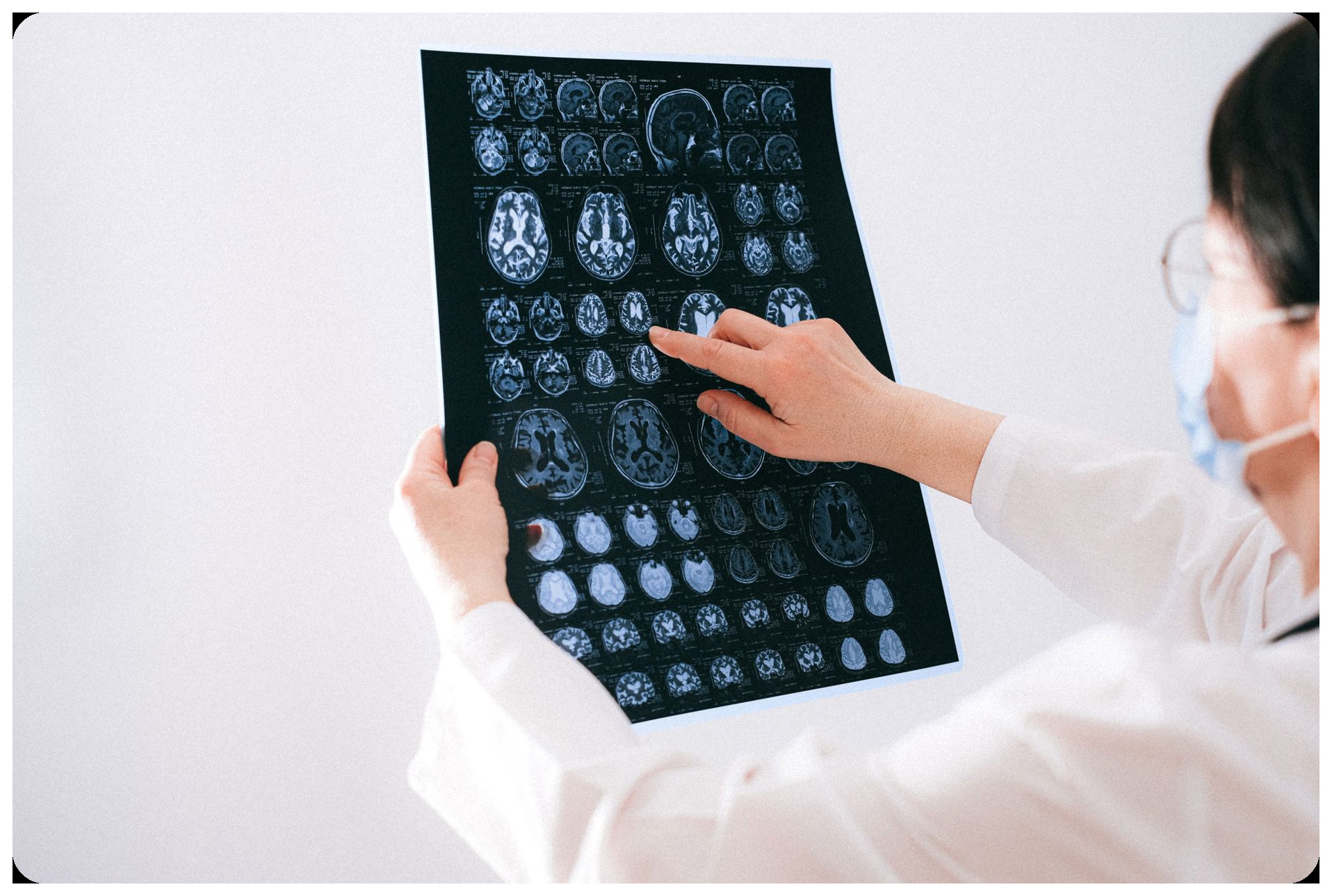 brain PET scan showing highlighted microthrombi glowing red spots, neuroscience laboratory high tech medical imaging equipment