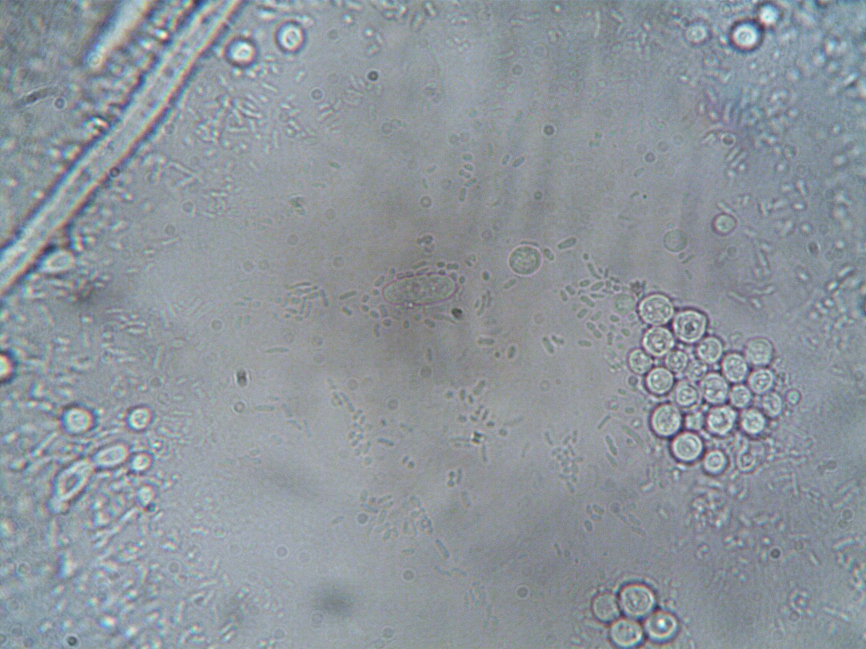 glowing blue stem cells dividing under microscope in dark laboratory dramatic scientific lighting